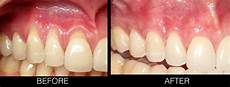 Crown Varnish