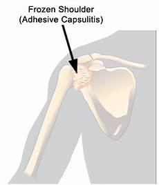 Curing Adhesive