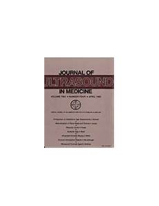 Perfluoro Chemicals