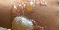 Pu Adhesive